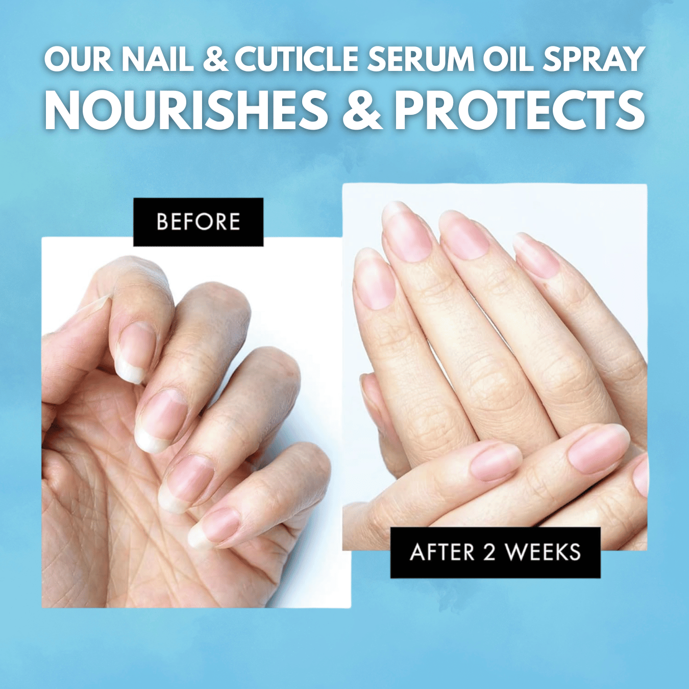 NailCare PRO Serum - For Complete Nail Protection and Fungus Free Nails